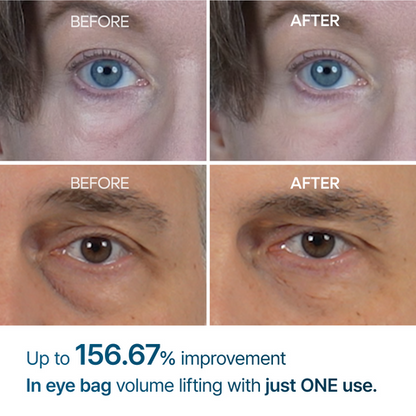 Dr. Melaxin Eyephalt Eye Bag Cream