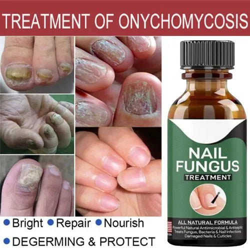 Nail Fungal Repair Serum