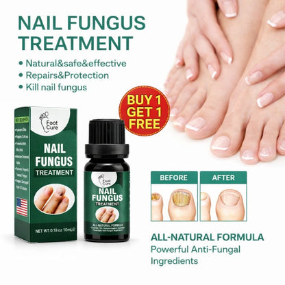 Nail Fungus Treatment Serum (10ml) | Get Healthy & Shiny Nails